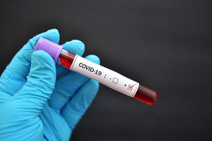 第一個獲美 FDA 緊急授權的新冠肺炎抗原快篩！僅需 15 分鐘但偽陰性高於 PCR
