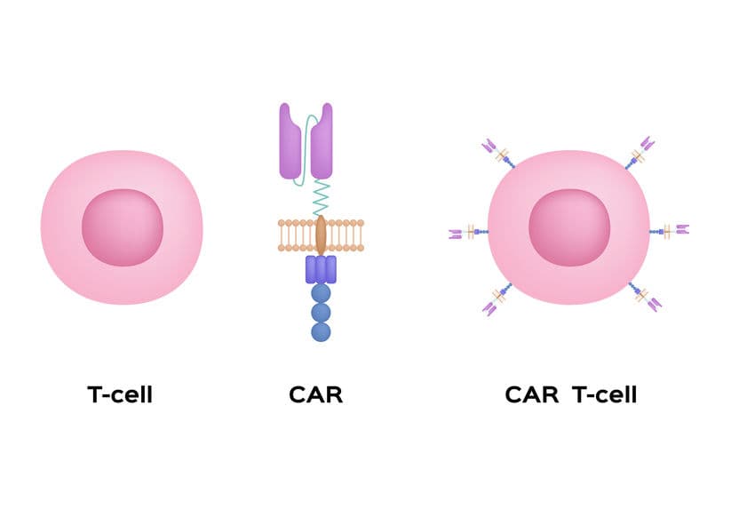 ASCO20 焦點:非基因編輯 CAR-T 抗直腸癌?腫瘤反應評估佳