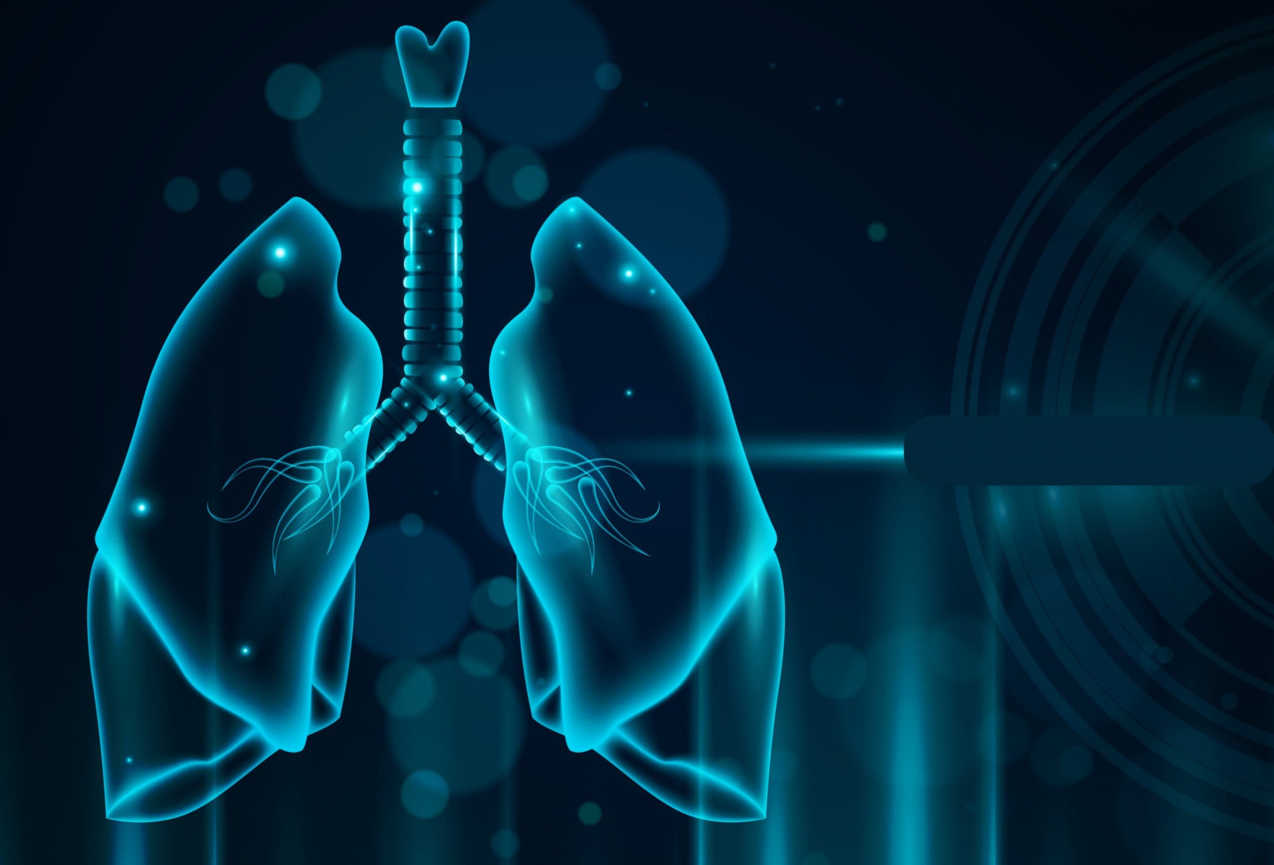 東亞第一個非吸菸肺腺癌深度蛋白體學綜觀研究!