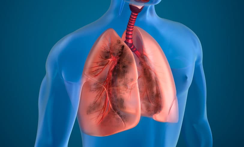 歐洲核准第一個肺癌雙免疫療法：nivolumab 合併 ipilimumab
