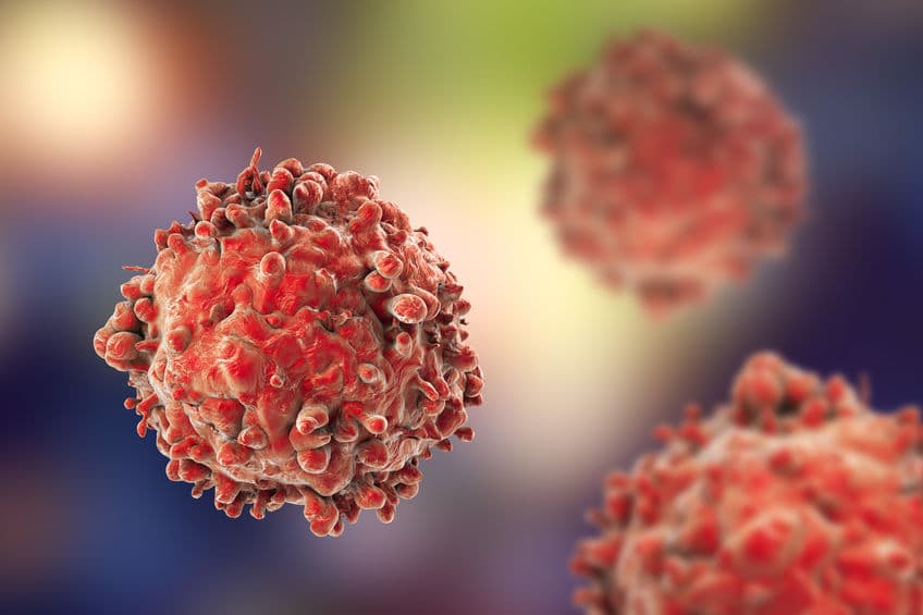 Kite 細胞療法佈局下一步：與 Oxford BioTherapeutics 找出 5 個抗癌新標靶
