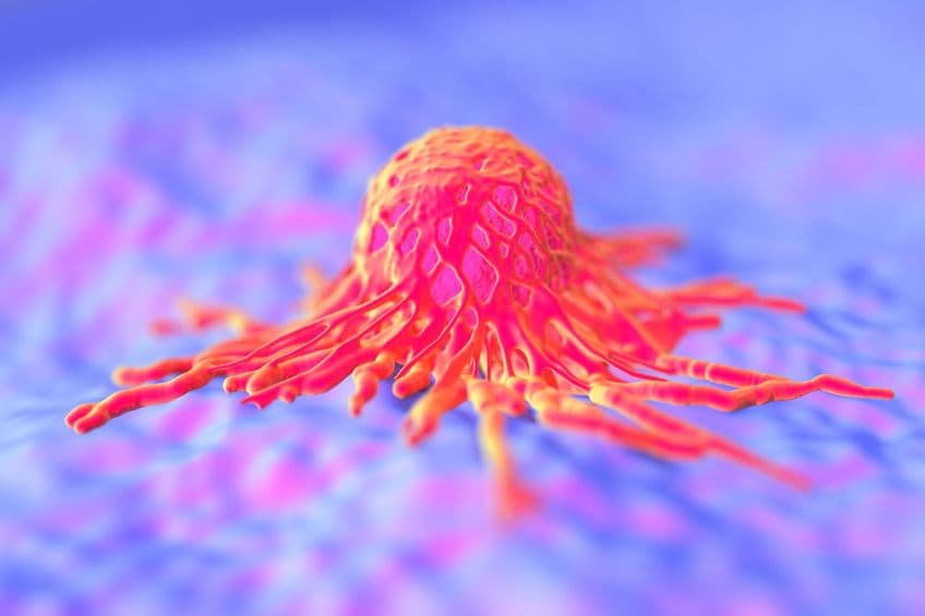 AACR 2021 精華：CAR-T 細胞遇到實體瘤就「筋疲力盡」？如何解決？