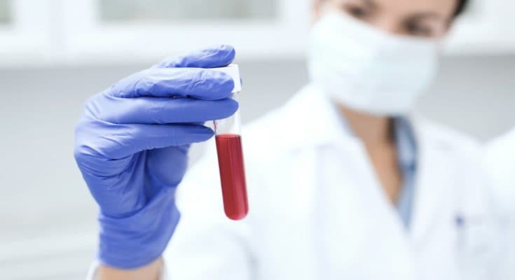 Liquid Biopsies