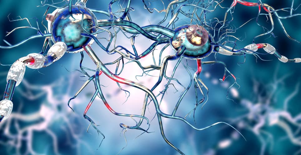 huntington disease