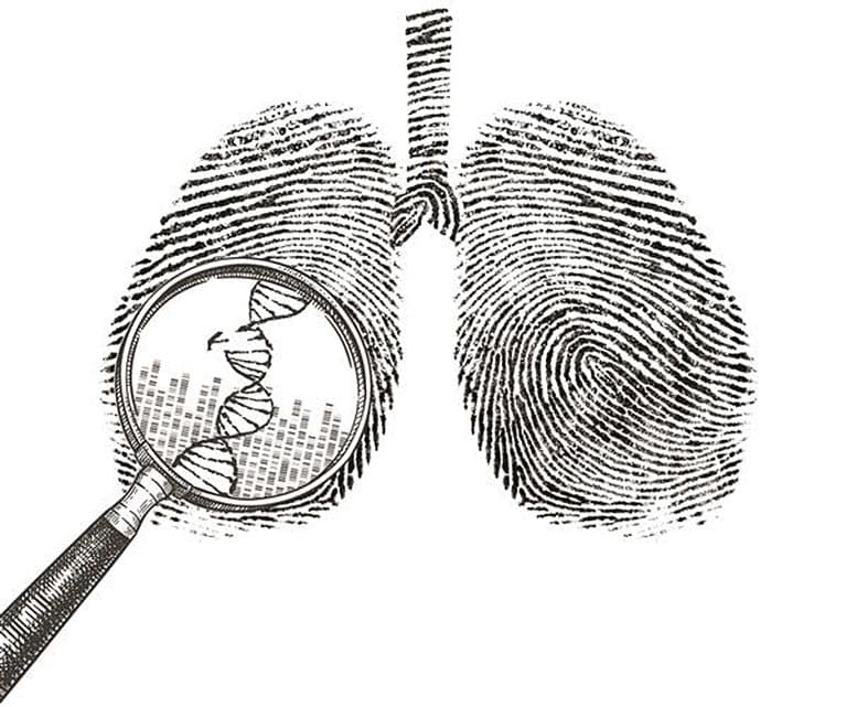 Lung-Cancer-Research