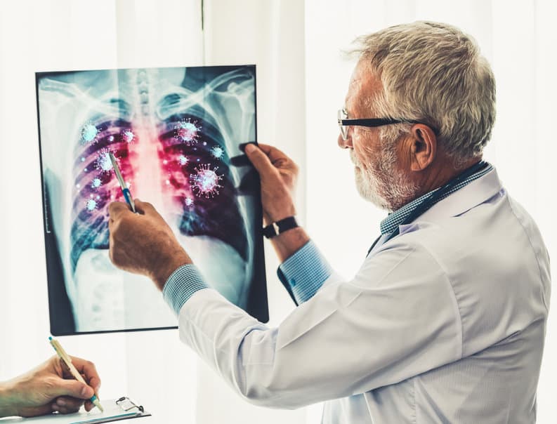 lung-cancer