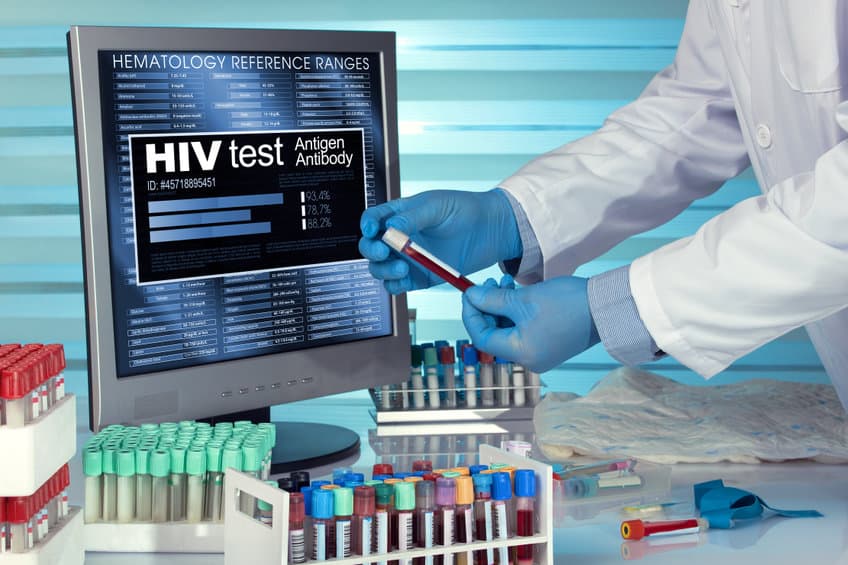 HIV test