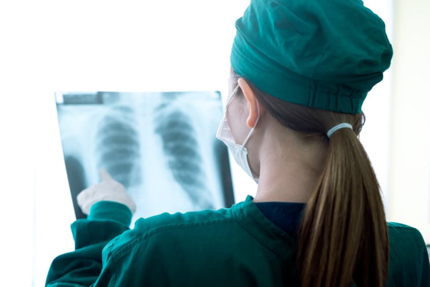 lung x-rays