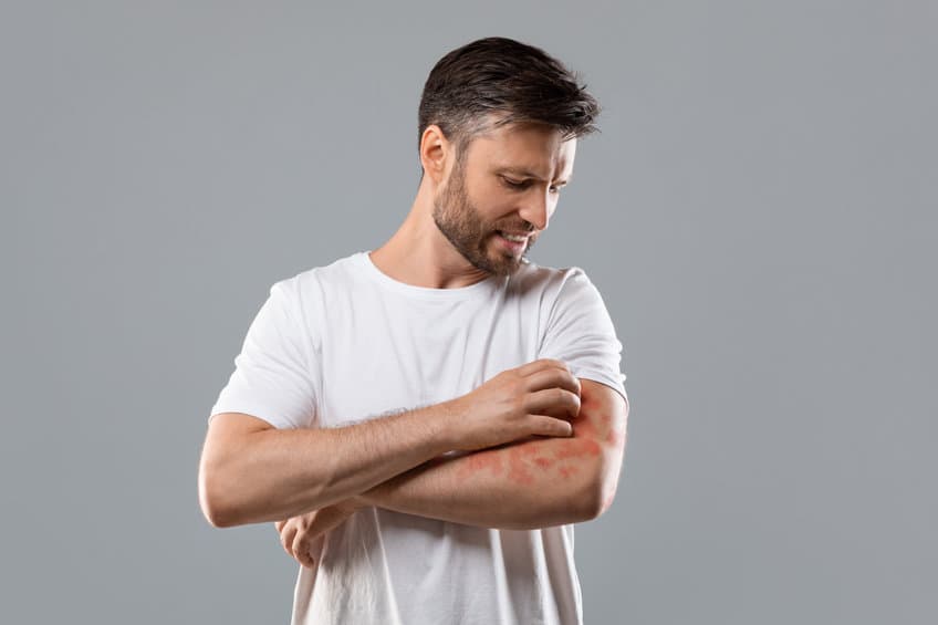 Dermatitis