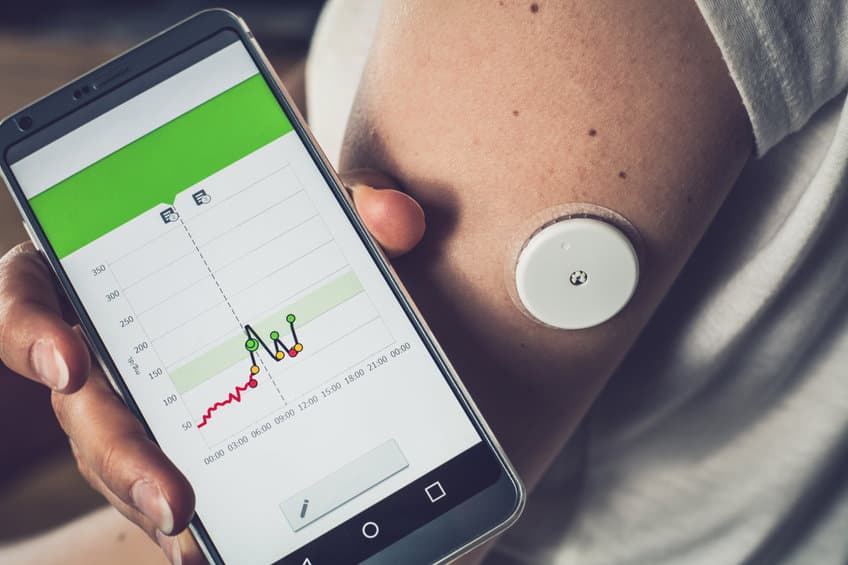 glucose monitor