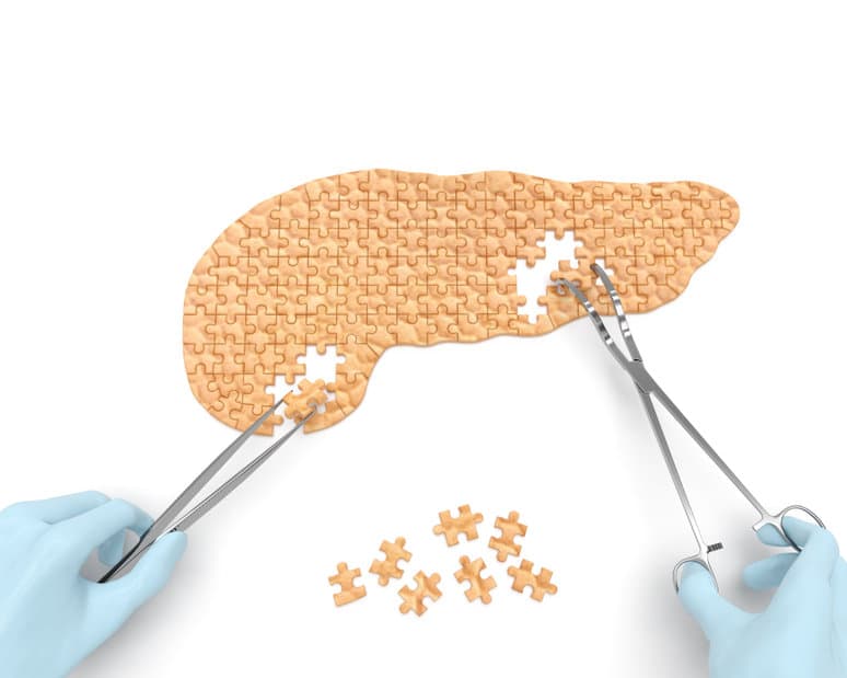 Pancreas