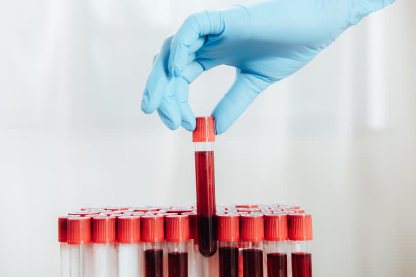 Quanterix 血液檢測技術可偵測多發性硬化症復發，獲 FDA 突破性設備認定