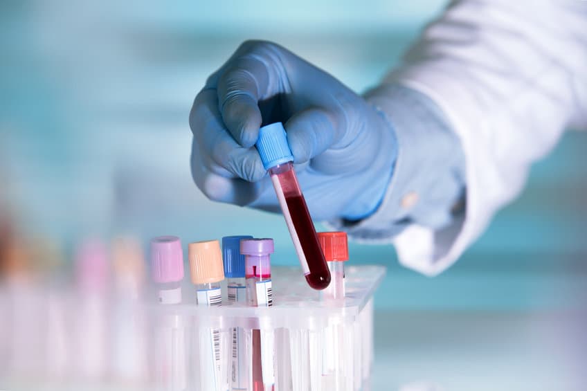 美研究分析大型臨床數據,發現 HIV 患者在感染新冠肺炎的風險較高?