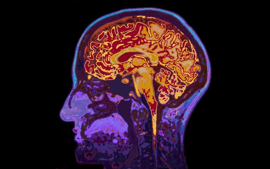 升級 MRI 造影新技術！DIANA 提高大腦內訊號的時間、空間分辨率