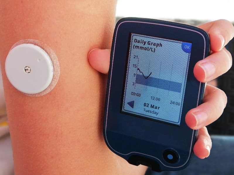 Medtronic 胰島素自動輸送與監測系統獲加拿大核准，造福第 1 型糖尿病患者