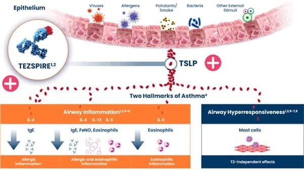 AstraZeneca 的嚴重氣喘藥物 Tezspire 在韓國獲得市場授權
