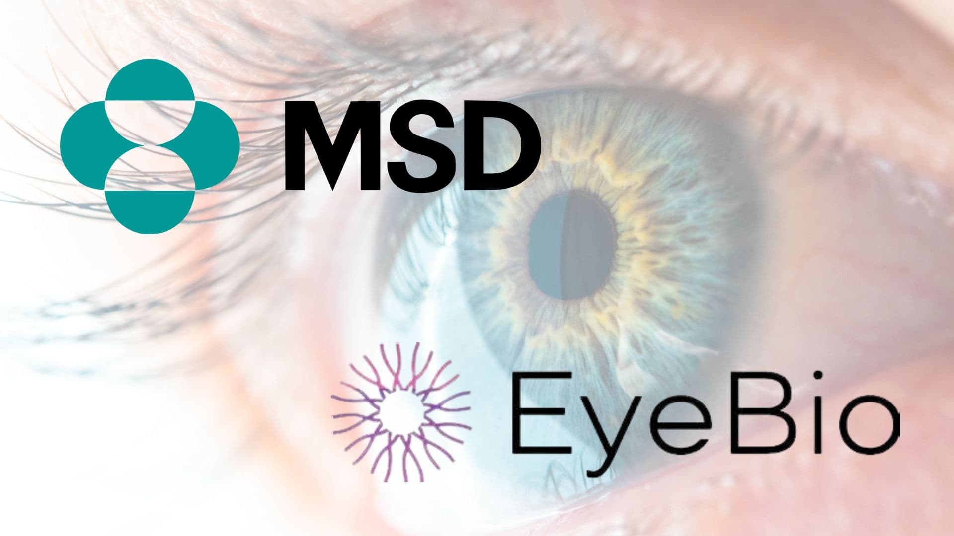 默克 30 億美元收購視網膜與黃斑變性眼科公司 EyeBio