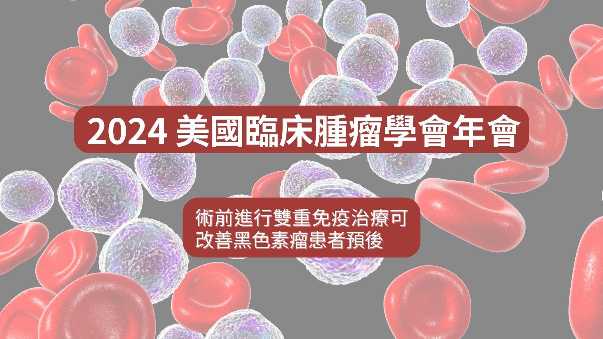 ASCO 2024 系列:術前進行雙重免疫治療可改善黑色素瘤患者預後