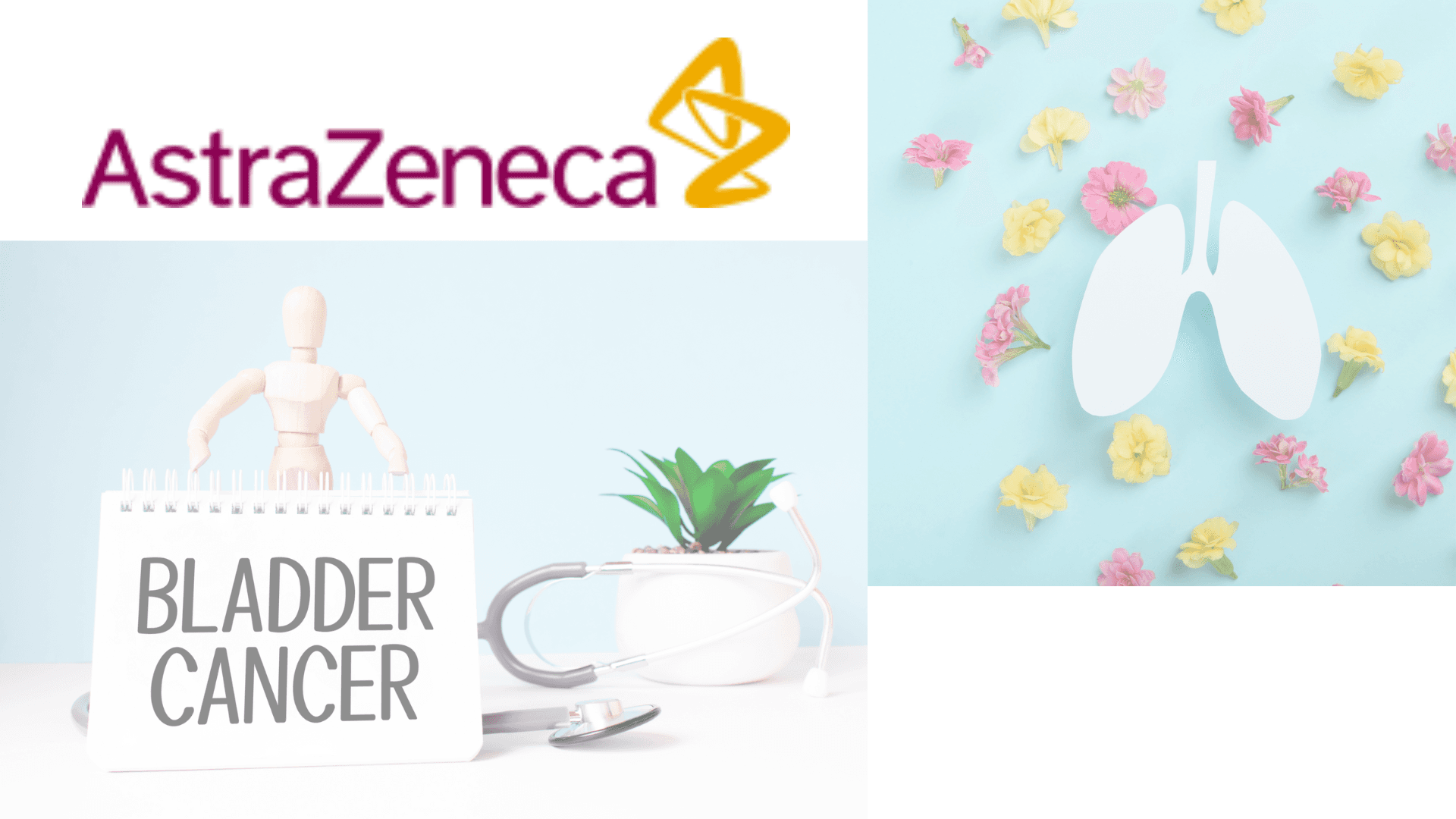 AstraZeneca 膀胱癌和非小細胞肺癌治療重要進展