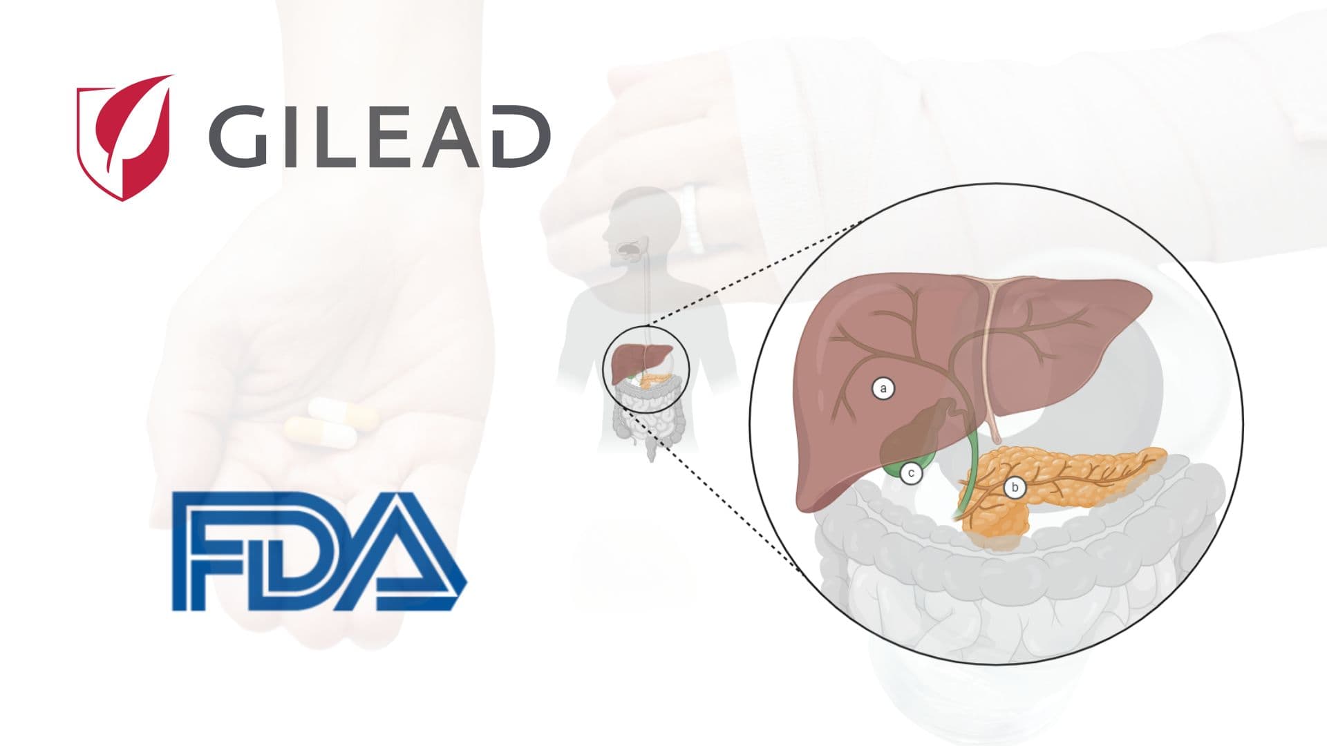 吉立亞醫藥原發性膽汁性膽管炎藥物獲美 FDA 加速批准