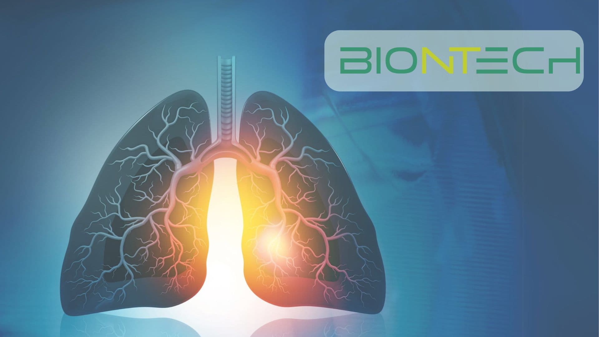 全球首個肺癌疫苗試驗展開!BNT116 mRNA 疫苗突破