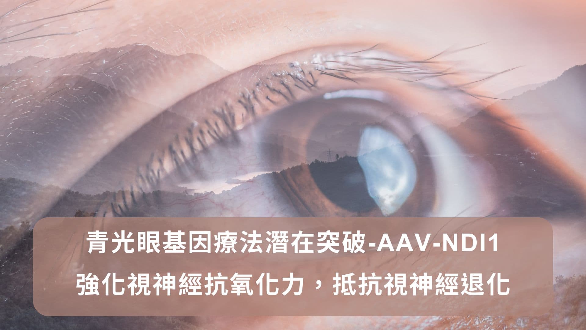 青光眼基因療法潛在突破—AAV-NDI1 強化視神經抗氧化力，抵抗青光眼視神經退化