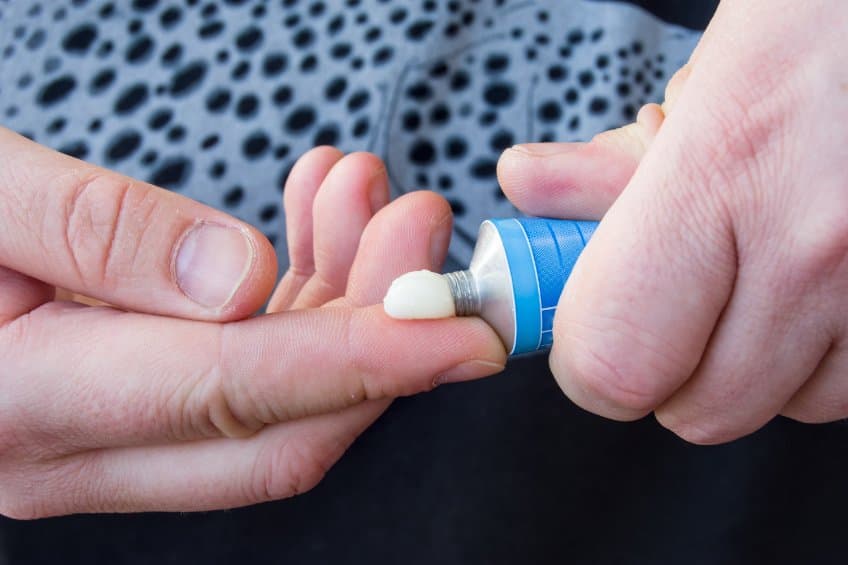 首款白斑症藥膏 Opzelura 獲 FDA 准!可用於治療 12 歲以上非分節性白斑患者