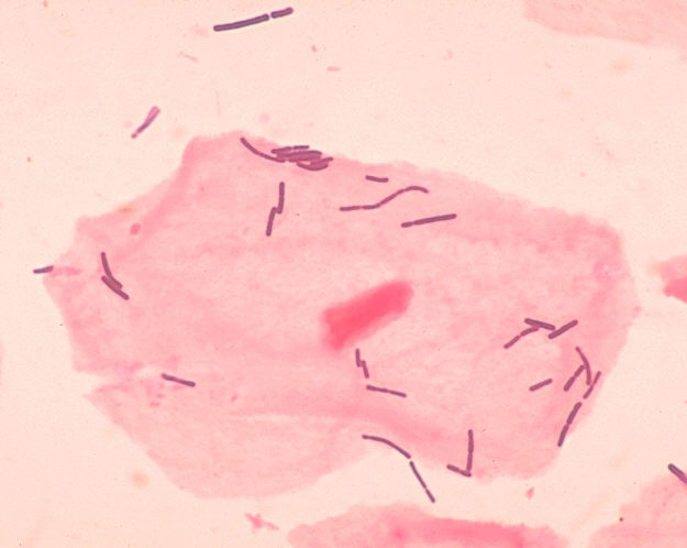  乳酸杆菌。图片来源：Wiki 