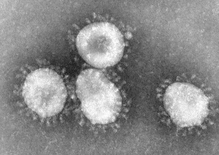  冠狀病毒。圖片來源：Wikipedia 