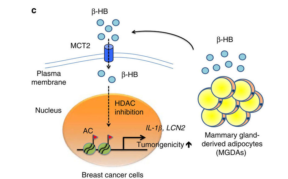 脂肪細胞分泌的 β-HB，能通過 MCT2 ，進入乳癌細胞內，進而活化下游 IL-1β 及 LCN2，最後促進腫瘤增生。