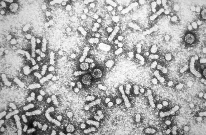 電子顯微鏡下的 B 肝病毒。來源：Wiki。