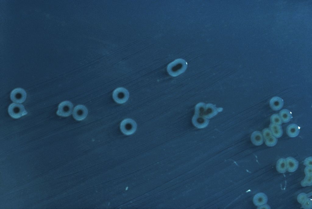 腸道沙門氏菌（Salmonella enterica），來源：Wiki。