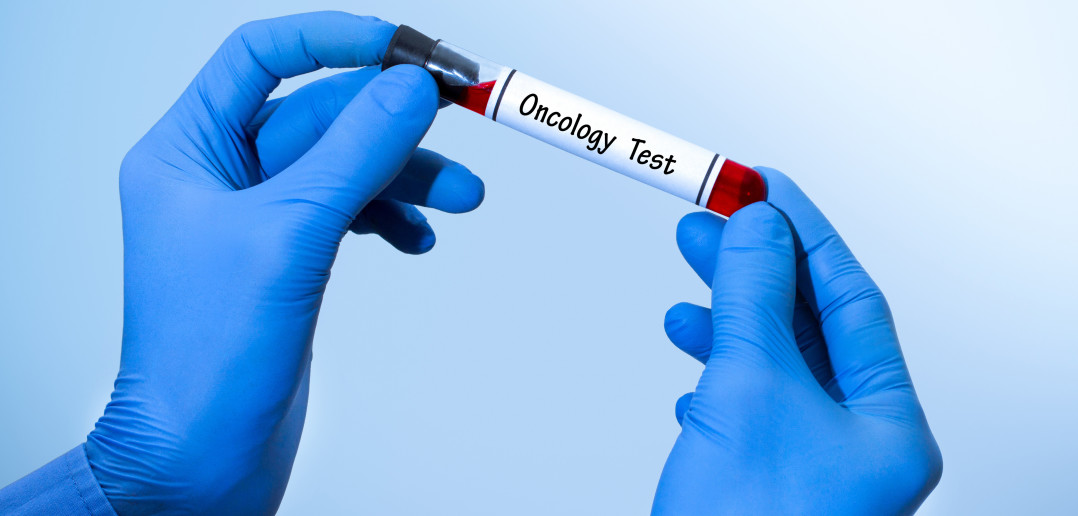 oncology test