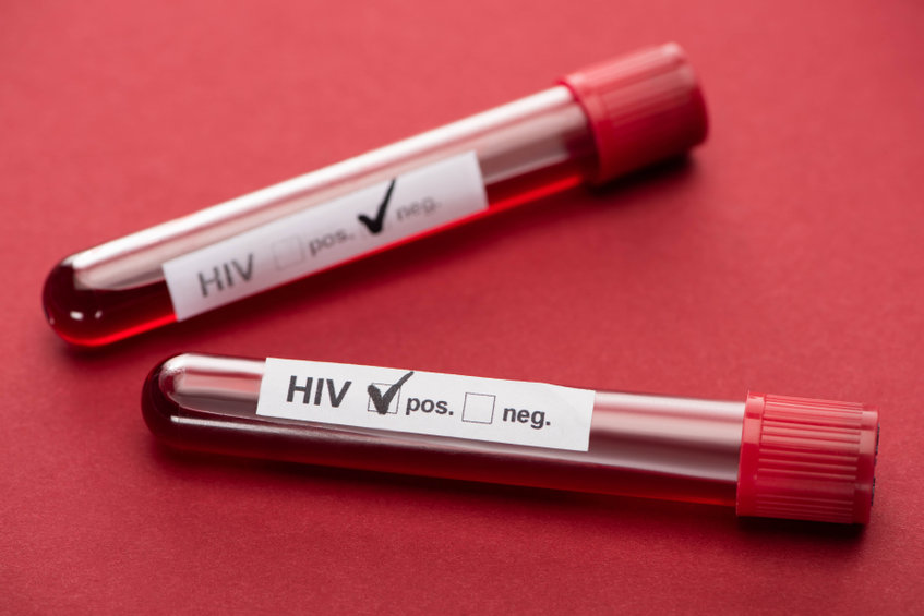 hiv-愛滋病